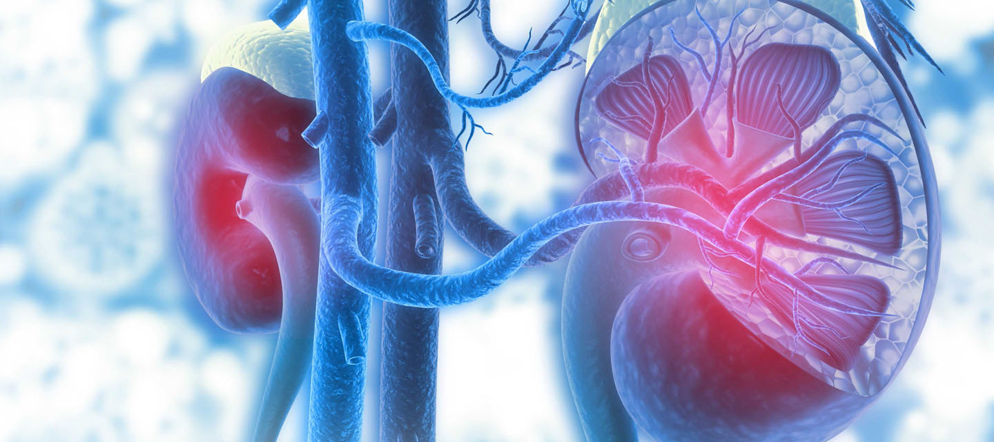 kidney transplant